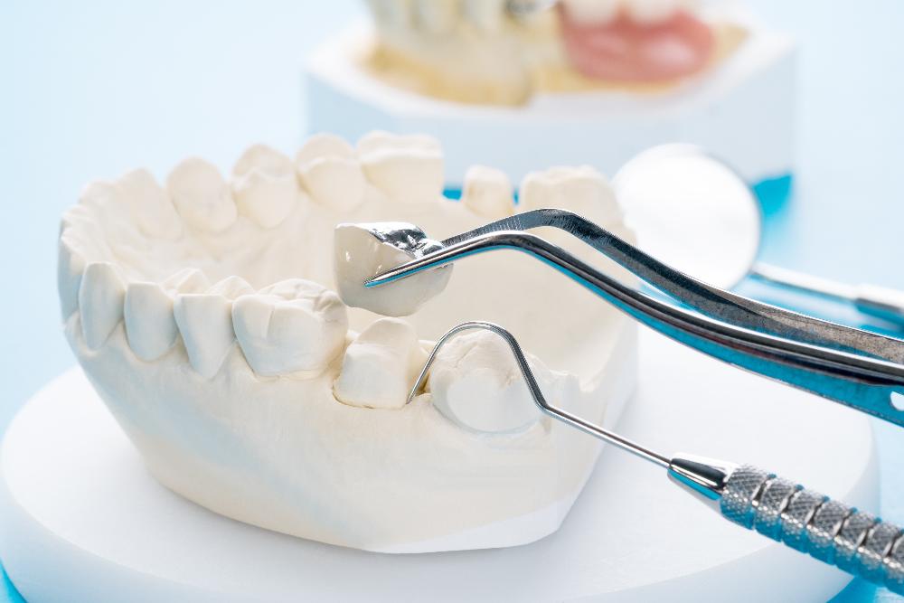 close up of dental tools | dentist oakbrook terrace il