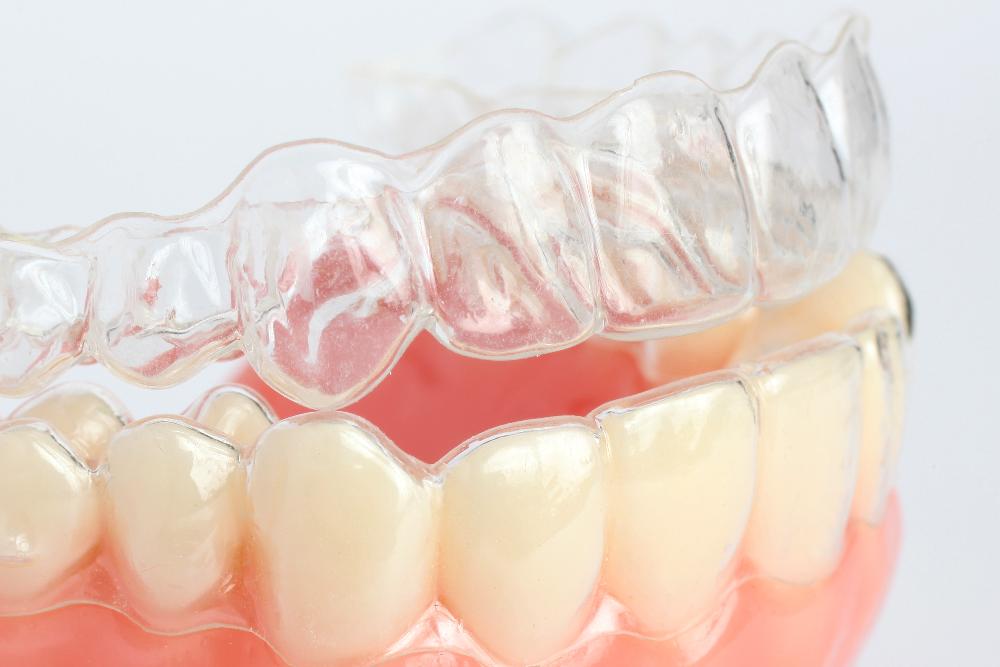 clear invisalign tray model | invisalign oakbrook terrace il