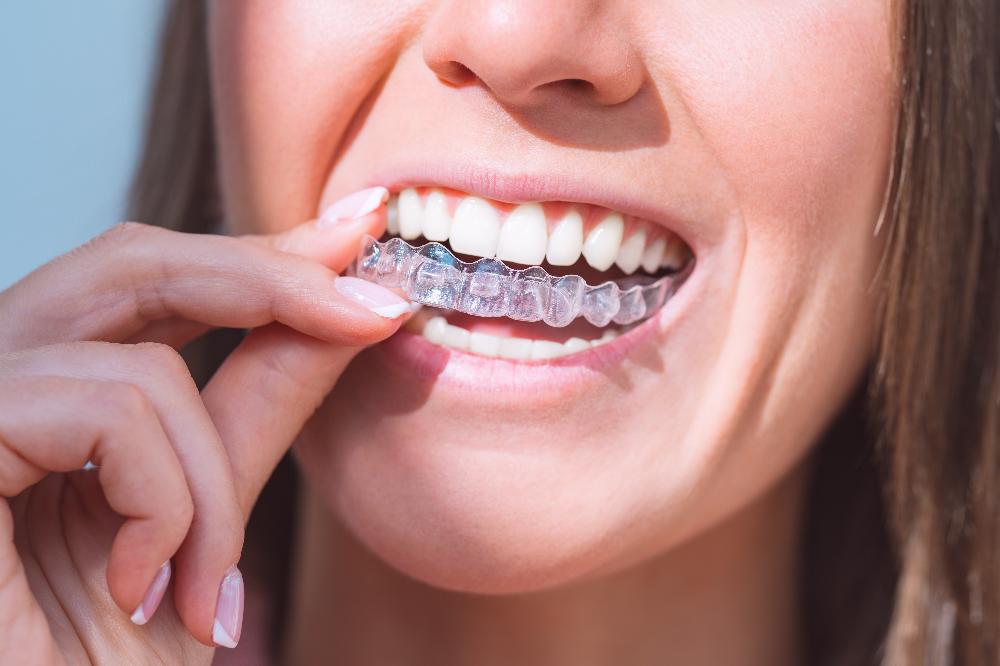 patient putting in invisalign aligner | invisalign oakbrook terrace