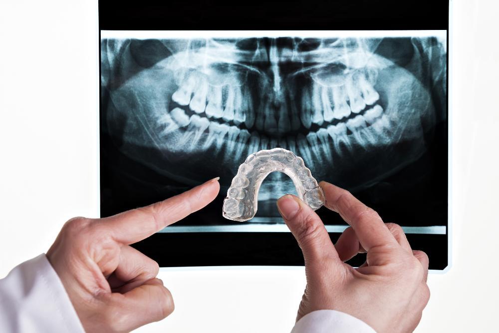dental x-ray in oakbrook terrace